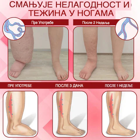 EdemaCare krema
