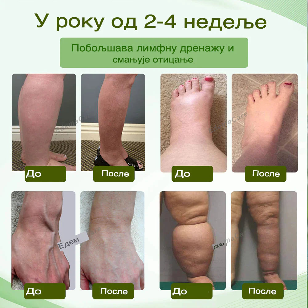 EdemaCare™ DetoxBreathe – Inhalator za detoksikaciju i zdravlje!